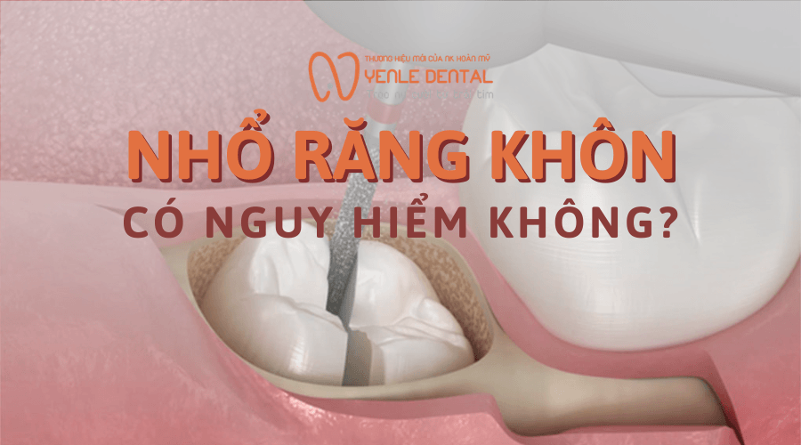 nhổ răng khôn có nguy hiểm không